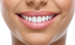 How Can Tooth Bonding Fix My Smile?