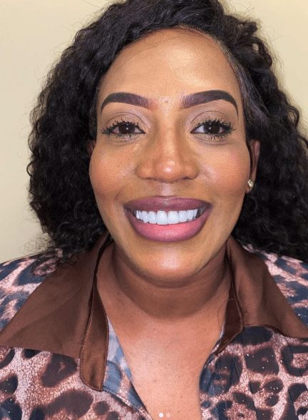 Cosmetic dentistry results at Cosmetic & Advanced Dentistry