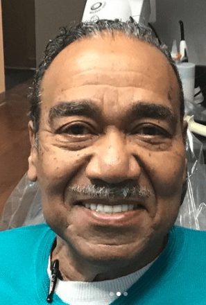 Cosmetic dentistry results at Cosmetic & Advanced Dentistry