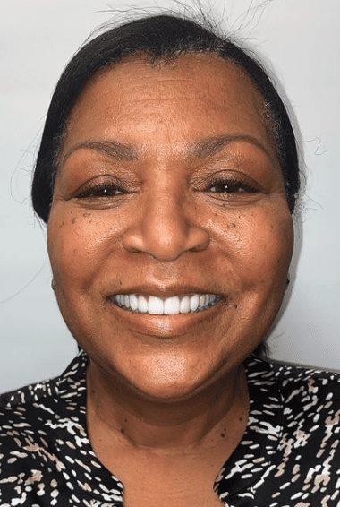 Cosmetic dentistry results at Cosmetic & Advanced Dentistry