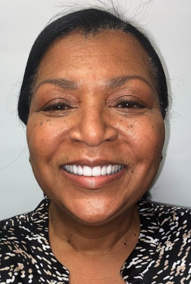 Cosmetic dentistry results at Cosmetic & Advanced Dentistry