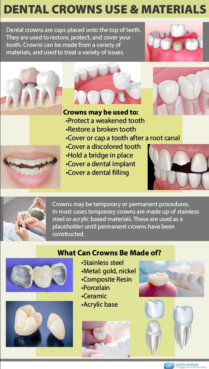 dental crown uses and materials infographic