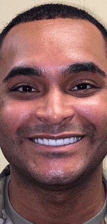 Cosmetic dentistry results at Cosmetic & Advanced Dentistry