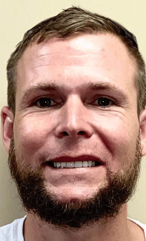 Cosmetic dentistry results at Cosmetic & Advanced Dentistry