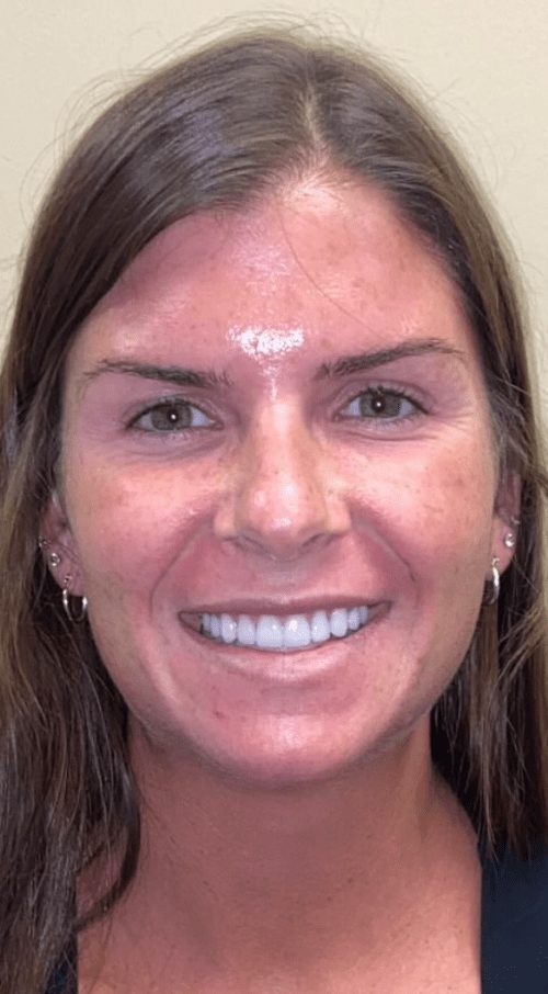 Cosmetic dentistry results at Cosmetic & Advanced Dentistry
