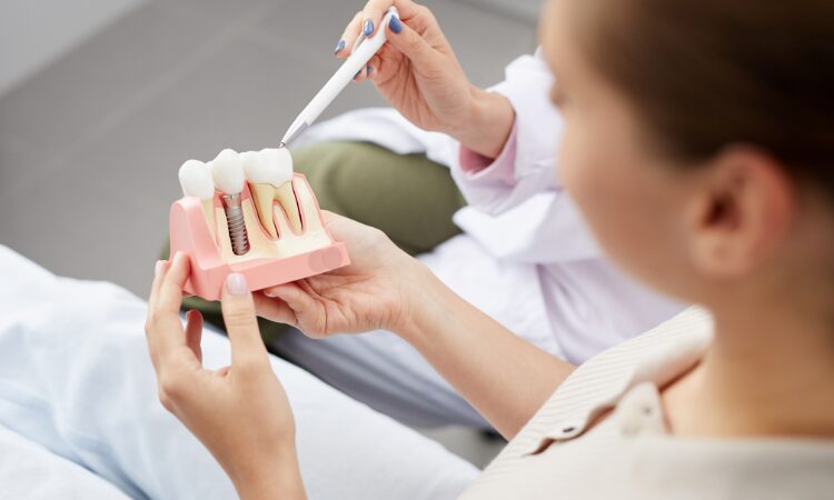 Understanding the advantages of dental implants can help you make an informed decision about your oral health. 