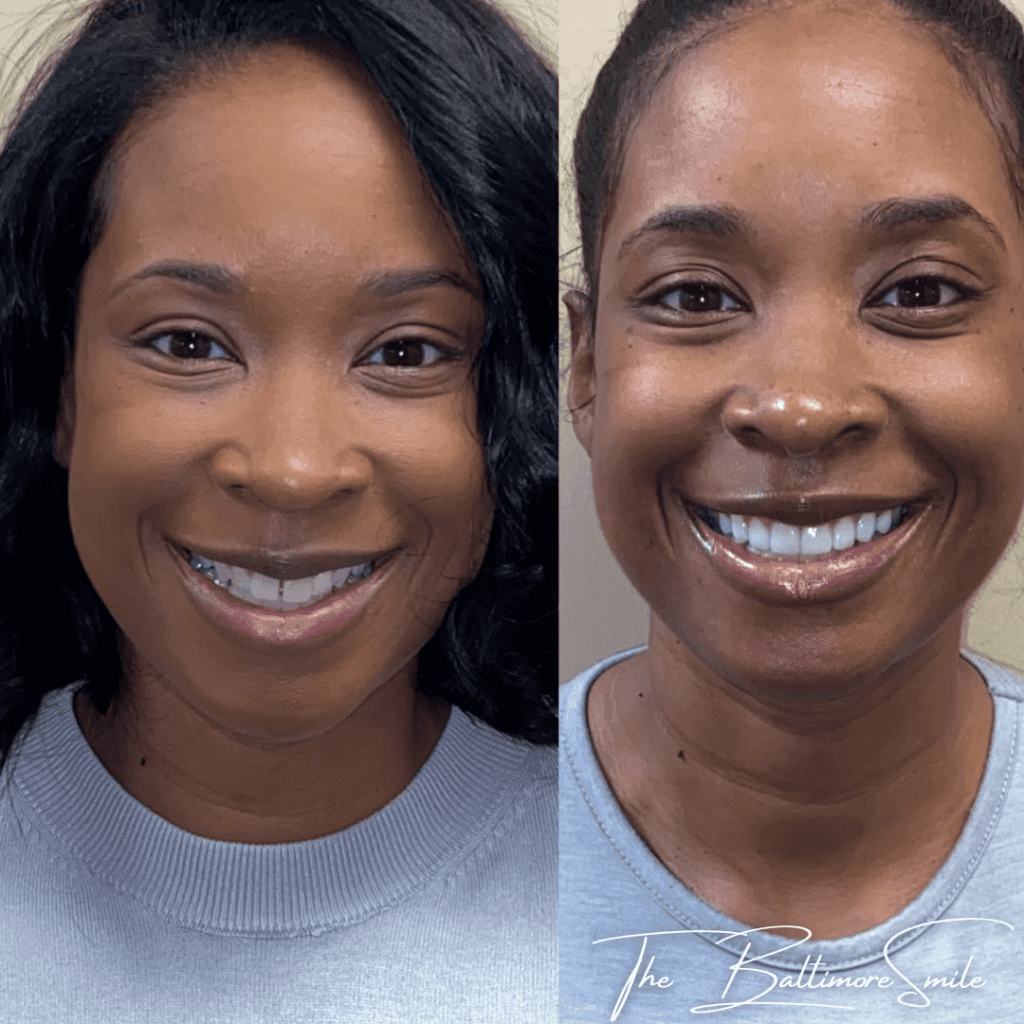 Happy dental patient