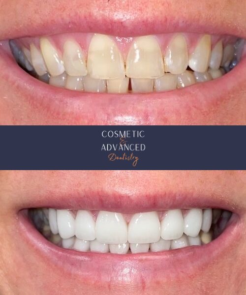 Patient after dental care at Cosmetic & Advanced Dentistry