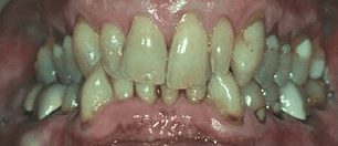 Screen-Shot-2021-08-26-at-11.45.07-AM